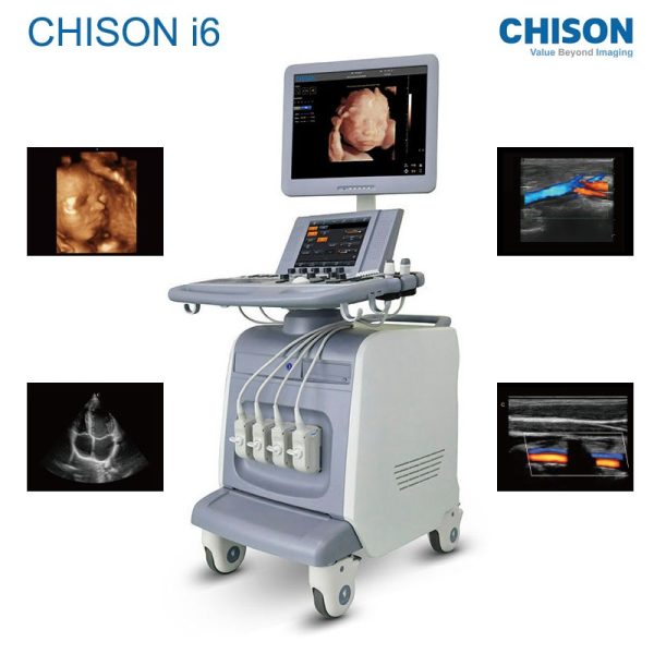 CHISON I6